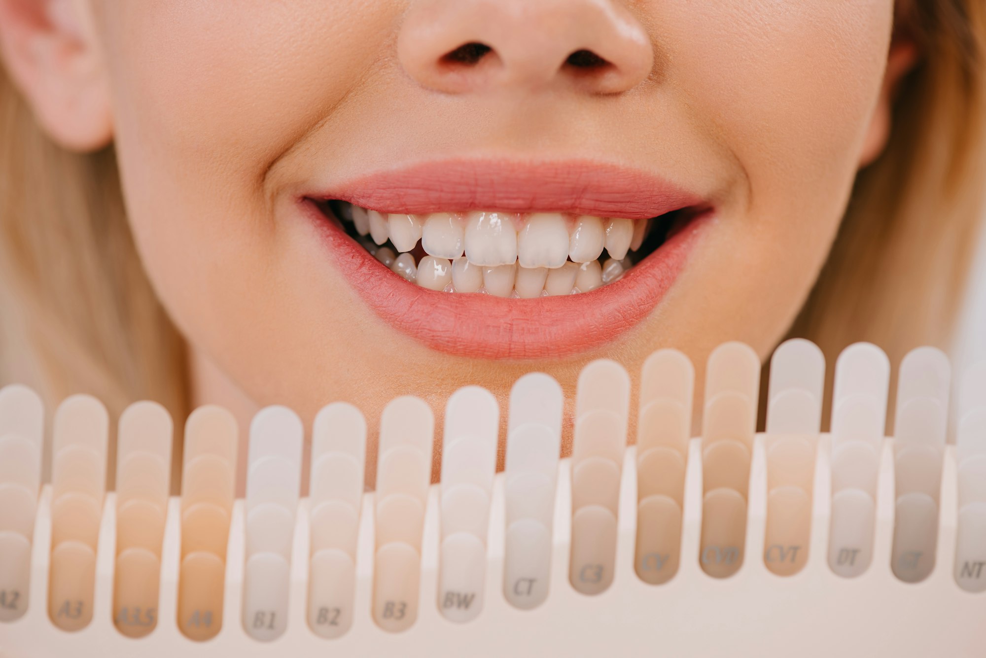 cropped view of smiling woman holding teeth color palette, teeth whitening concept